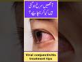 Pink Eye Prevention And Treatment Ashob E Chashm Ehtiat Aur Ilaj Pink Eye Prevention And Treatment Ashob E Chashm Ehtiat Aur Ilaj