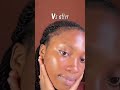 Before & after Korean skincare How my skin changed with 345 cream @Dr Althea US #postacnecream