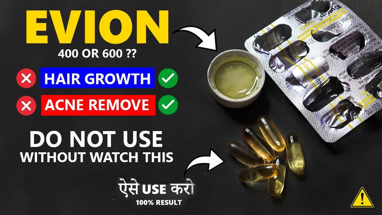 EVION कैसे USE करे ? वरना हो सकती है PROBLEM ( EVION 400 or 600 ) REAL  TRUTH ABOUT EVION - YouTube