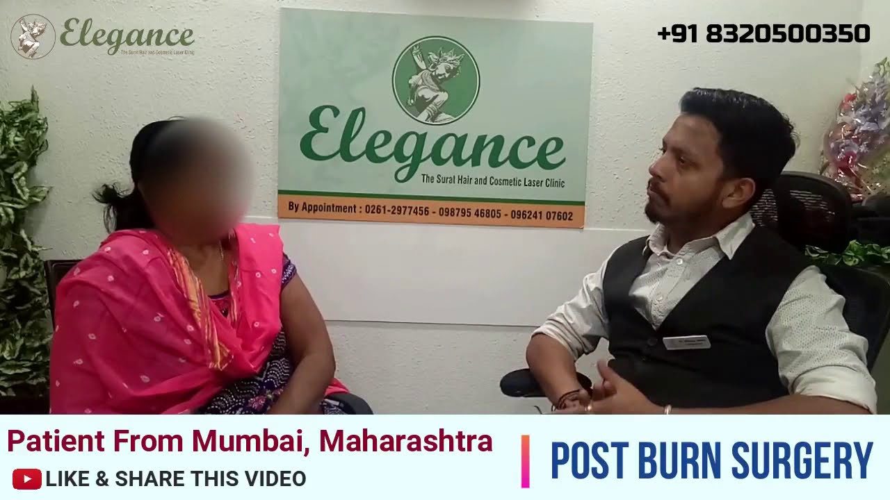 Review From Mumbai, Maharashtra For Post Burn Surgery, Burn Treatment