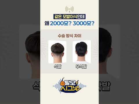 같은 모발이식인데 왜 2000모? 3000모?