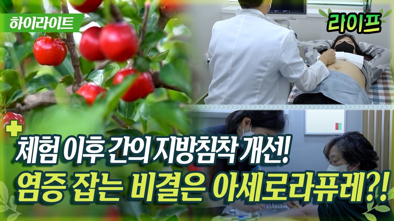 체험 이후 간의 지방침착 개선! 염증 잡는 비결은 아세로라퓨레?! #염증 #지방 #다이어트 [라이프]