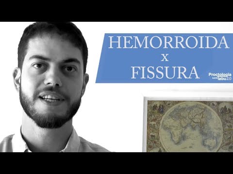 Vídeo: Diferença Entre Hemorróidas E Fissuras