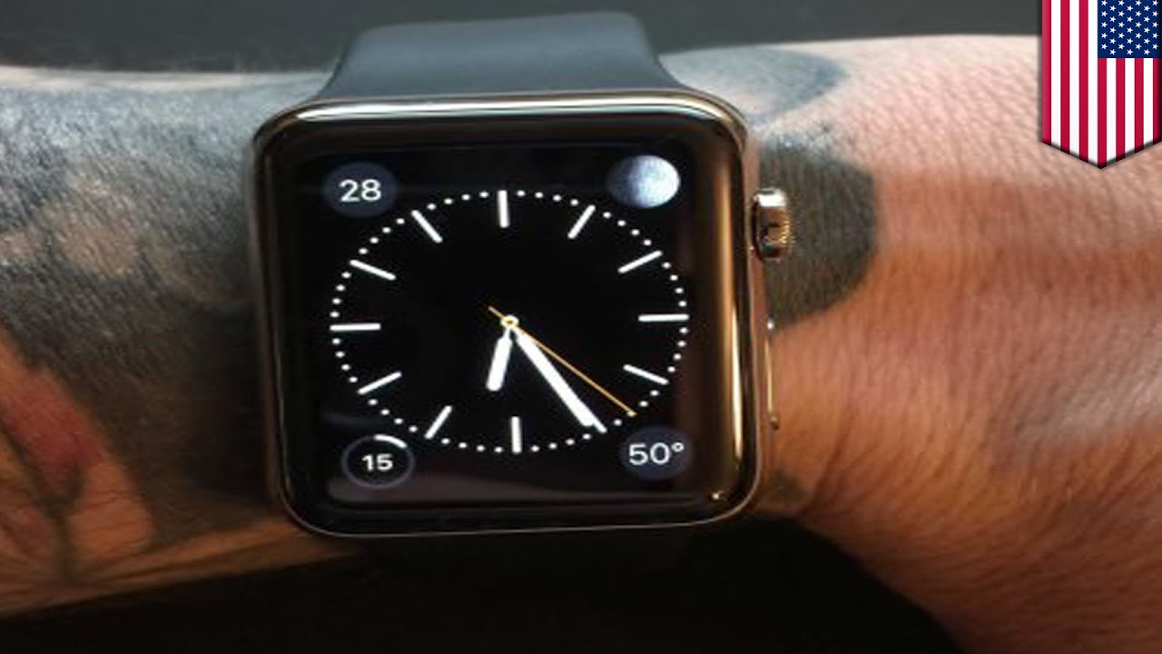 Man Says Apple Watch App Helped Detect Blood Clot, Saved His Life