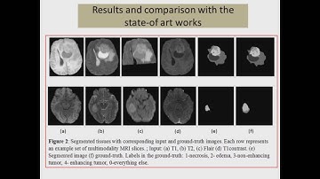 Automatic Brain Tumor Segmentation