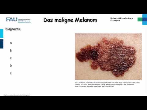 Video: Typer Immunterapi For Metastaserende Melanom
