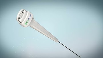 EnPlace® Procedure Overview