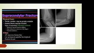 Elbow fracture in children screenshot 5