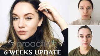 MY PROACTIV 6 WEEKS UPDATE | SKAI