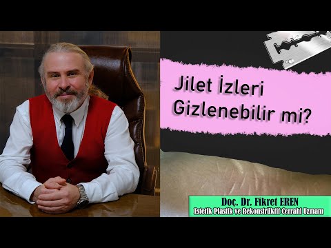 Jilet İzleri Nasıl Gizlenir?