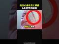 【30秒後に涙腺崩壊】歯を目に移植!?20年ぶりに妻の顔を見るために大手術。結果は?#感動#感動動画#感動する話#すっきり#スカッと#海外の反応#shorts