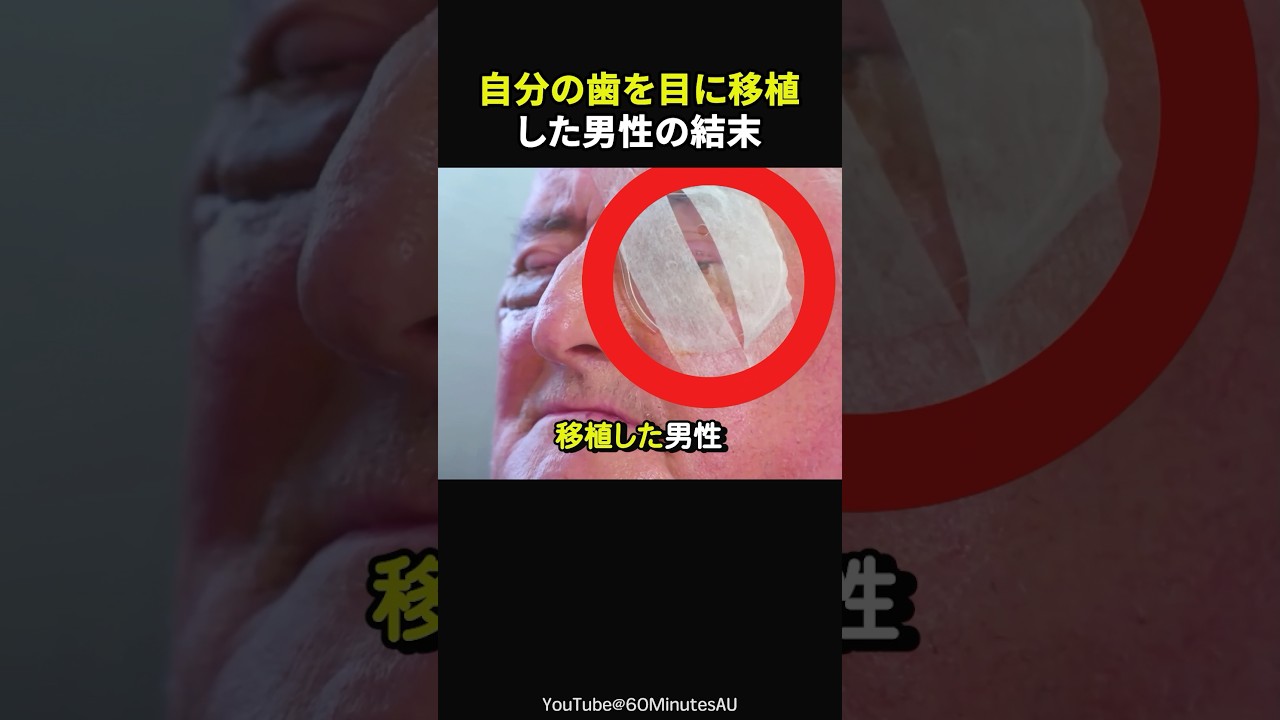 【30秒後に涙腺崩壊】歯を目に移植!?20年ぶりに妻の顔を見るために大手術。結果は?#感動#感動動画#感動する話#すっきり#スカッと#海外の反応#shorts
