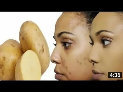 Dawaa Fulaa Nuu Gugurachaatee Madaatii Bugura Ykn Qorichaa Isaa Ykn Furmataa