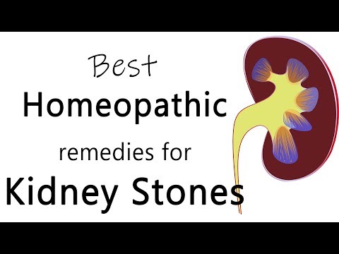 Best homeopathic medicine for stone in kidney - Dr. Sanjay Panicker