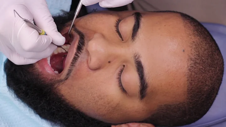 Should Metal Fillings Be Replaced? | Mark Givan, DDS