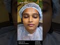 Microblading Before & After | Parisiya Academy