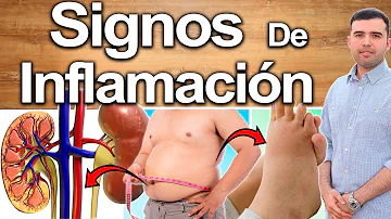 ¿Cómo sabe si su cuerpo está inflamado?