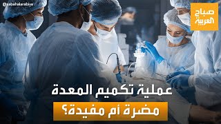 هل تكميم المعدة هو الحل السحري للسمنة؟.. جدل حول الفوائد والمخاطر