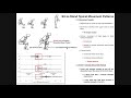 Biomechanics and Events of the Sit-to-Stand