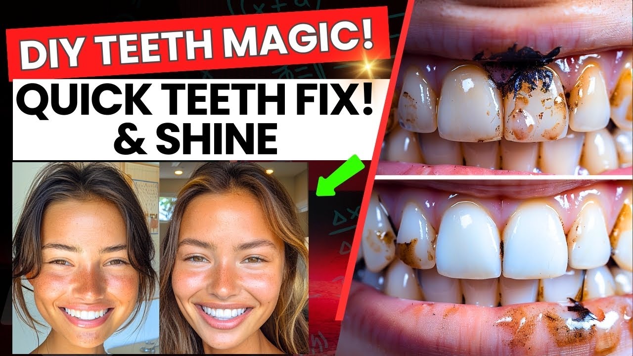 Fast Teeth Whitening Hacks You Can Do at Home! Yellow Teeth to White 🦷 ...