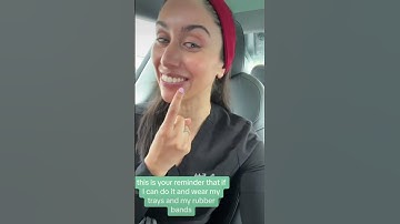 SPARK ALIGNER TIPS #invisaligntips #clearaligners #motivation