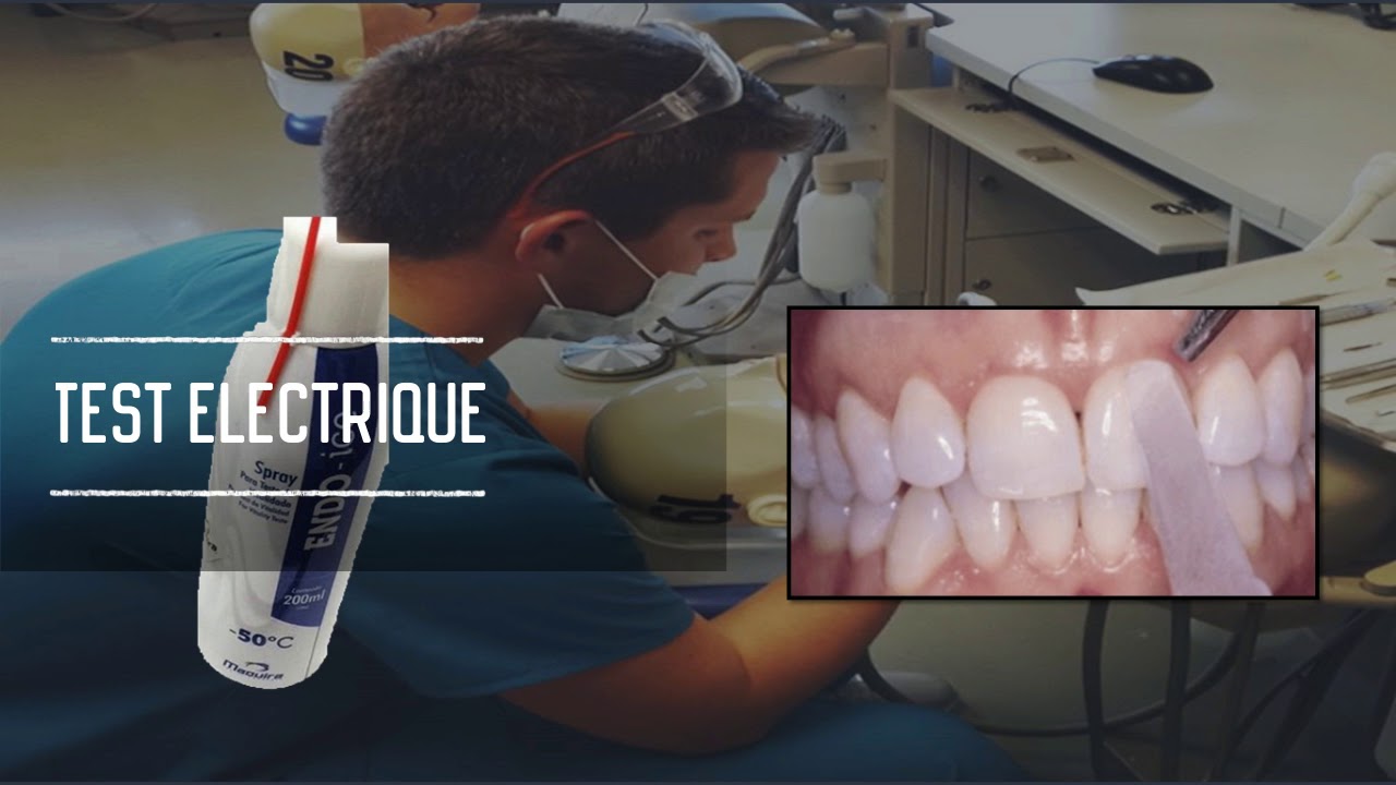 Les tests en odontologie conservatrice et endodontie