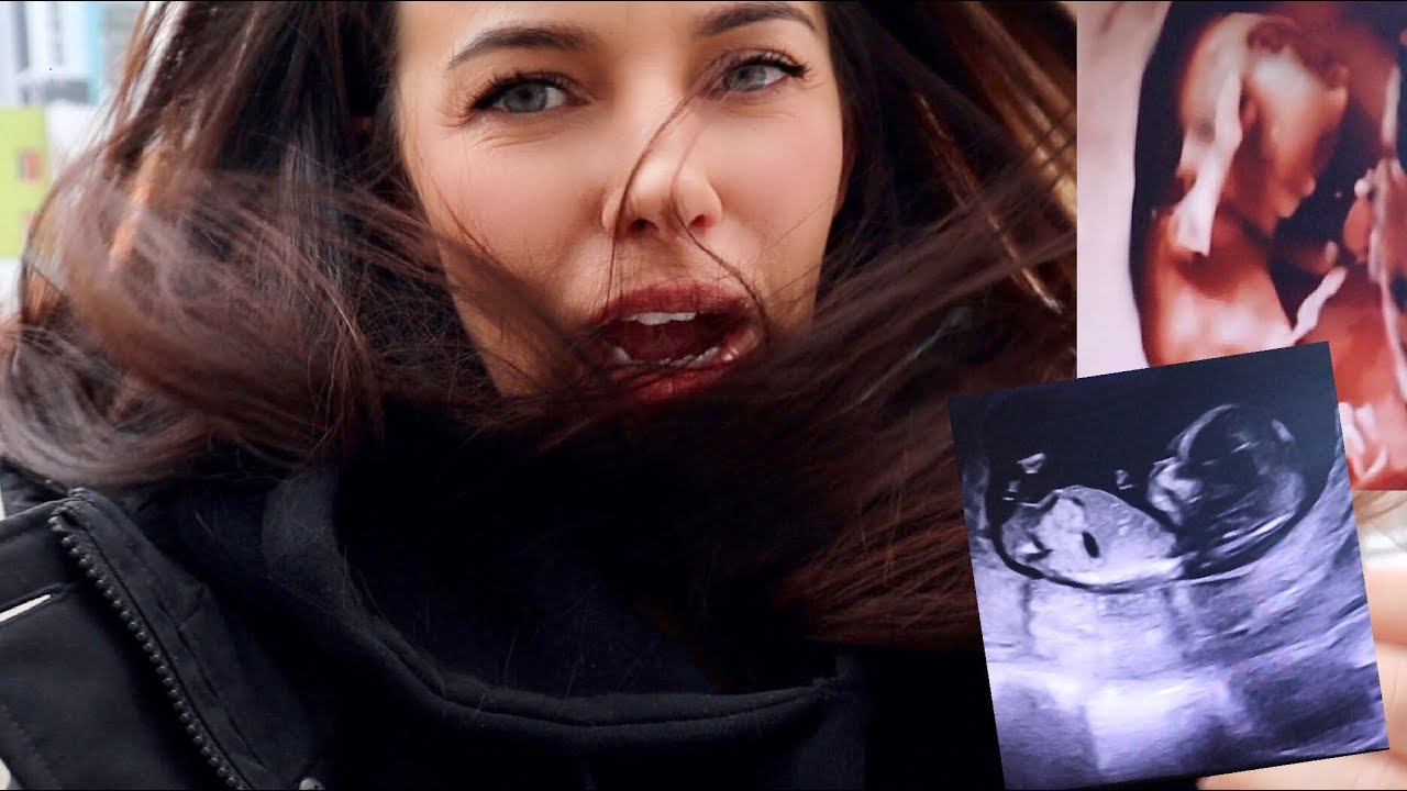 БЕРЕМЕННОСТЬ #2 | ПЕРВЫЙ СКРИНИНГ НА 14 НЕДЕЛЕ БЕРЕМЕННОСТИ | НАЧАЛО ...