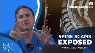 Paralyzed from Epidural Steroid Injection (Ep. 5 Spine Scams Exposed)