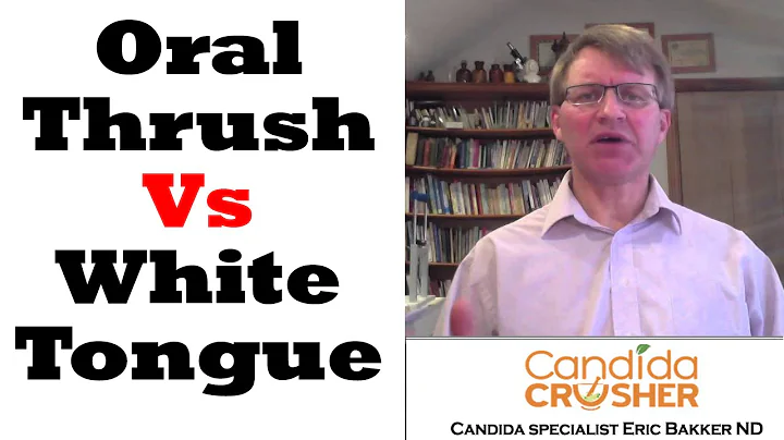 What Is The Difference Between A White Tongue And ...