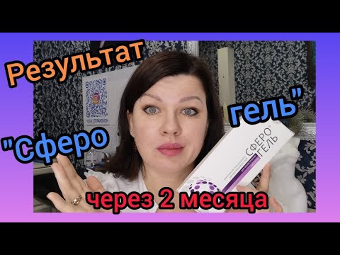 Сферогель Купить