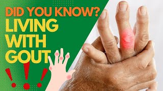 Did You Know Living With Gout