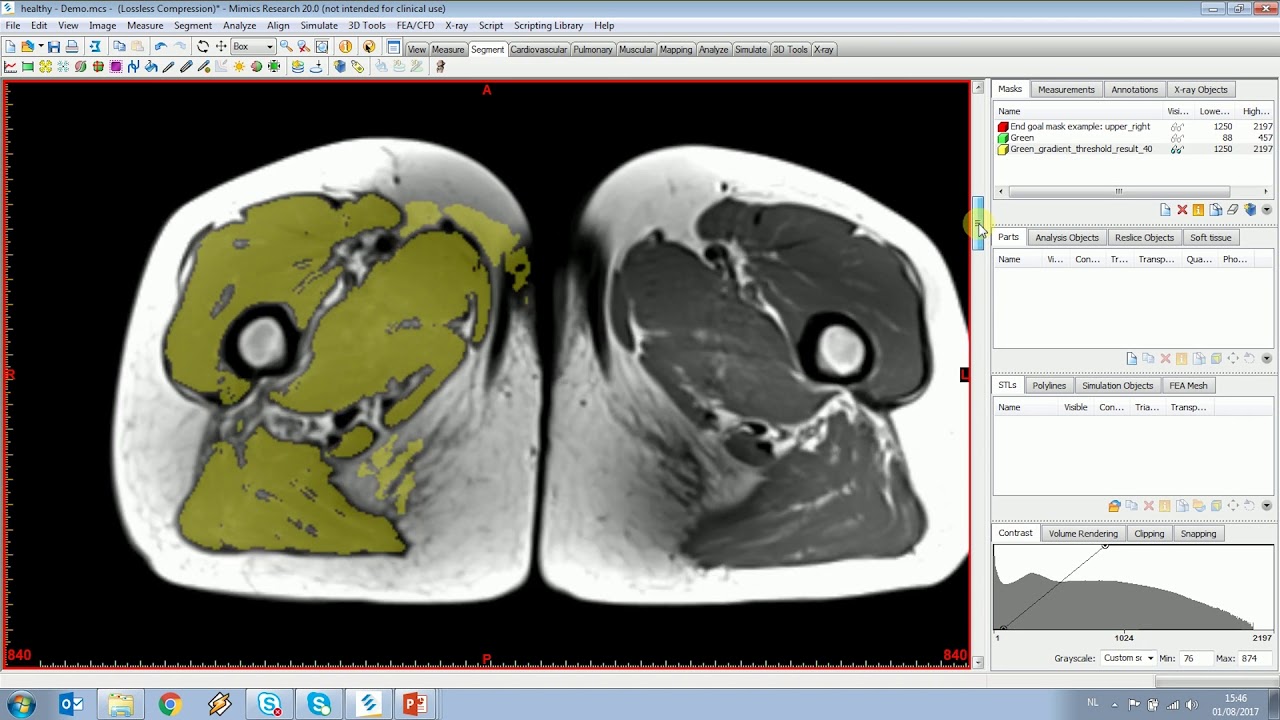 segmentation imuscle segmentation imuscle