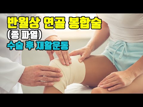 [서울백병원] 반월상 연골 봉합술(종 파열) 후 재활운동 / Meniscus Repair(Longitudinal Tear)