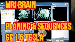 Brain MRI scan Protocol, Positioning and Planning screenshot 2