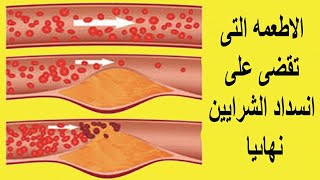 الاطعمة التى تقضى على انسداد الشرايين