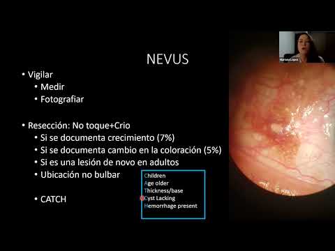 Nuevos Enfoques en Lesiones Pigmentadas Conjuntivales