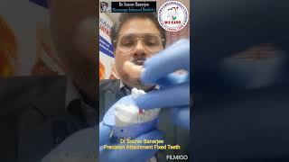 Fixed teeth for them who can't go for implant