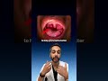 ENT Explains The Best Surgeries For Sleep Apnea Sleepapnea Ent Mouthbreathing Allergies Allergy