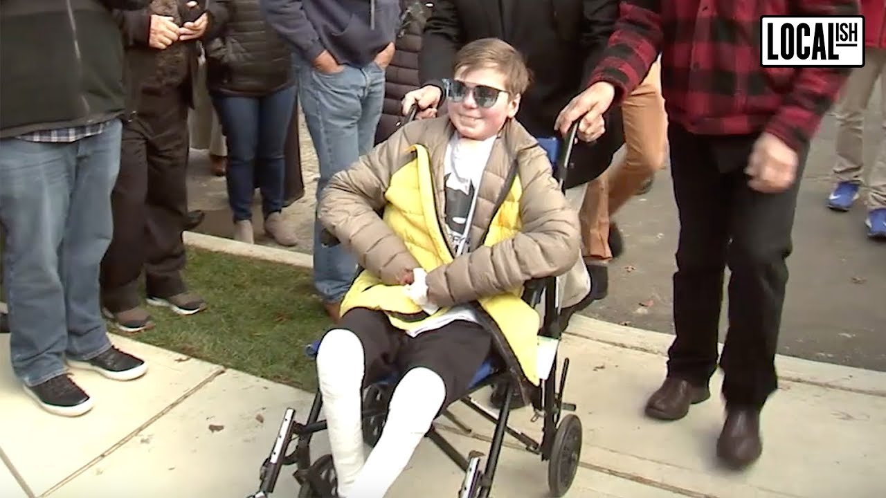 John Hudson Dilgen Boy With Rare Skin Condition Gets New Smart Home