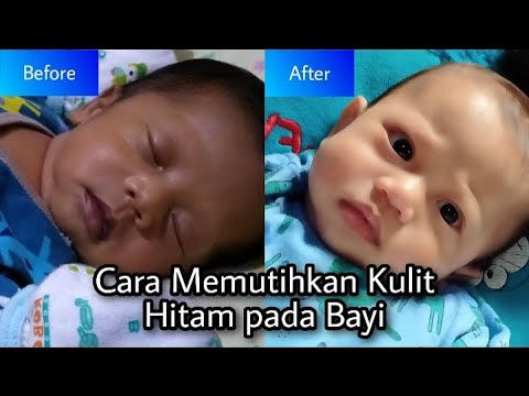 Video: Penjagaan Bayi Spiny Lembut Penyembuhan Bayi Saya
