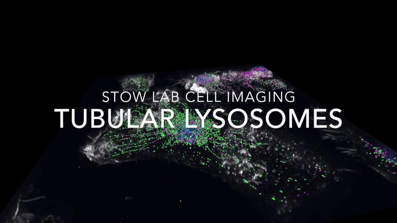 Tubular Lysosomes: Stow Lab Cell Imaging