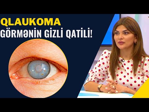 Gözdə Gizli Gedən Xəstəlik QARA SU - Vaxtında Müalicə Olunmasa...