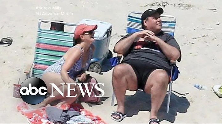 Burned at the beach: Governor Chris Christie photo...