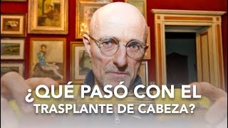 ¿Qué rayos pasó con el trasplante de cabeza? | LO ÚLTIMO 2018 - Salud en Corto
