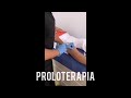 Dr Alvaro Medicina Regenerativa del Dolor - Condromalacia Patelar y Artrosis de Rodilla