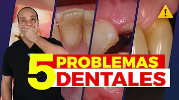 ¿Cuáles son los cinco problemas dentales más frecuentes?