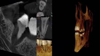 dental tomografi ve sefolometrik 