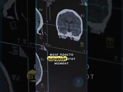 Ты никогда не видел, как двигаются твои глаза👁️ #фактдня #интересно #багтела #мозг #Shorts #mindblow