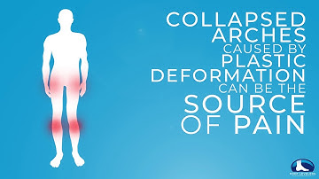 Plastic Deformation Explained