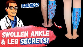 STOP Swollen Ankles & Swollen Feet [Treatment SECRETS 2024]! screenshot 4